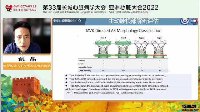 VR彩票GWICC 报道丨主动脉瓣关闭不全论坛：齐头并进 探索创新(图3)